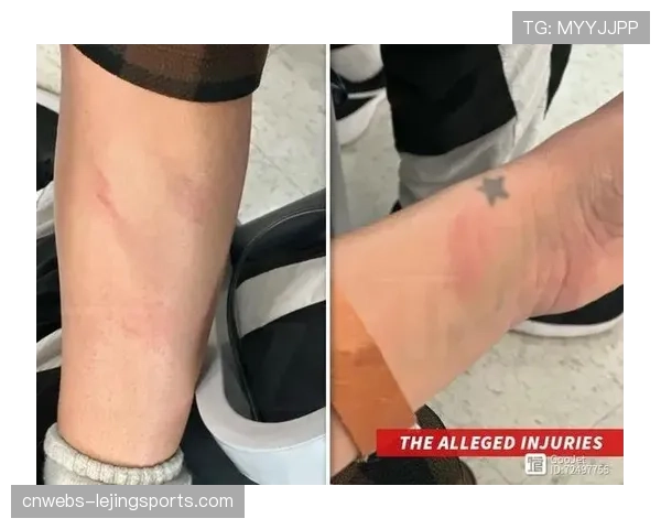 针对狂热队球员的网络暴力案告破，一名肇事者在加州被警方逮捕